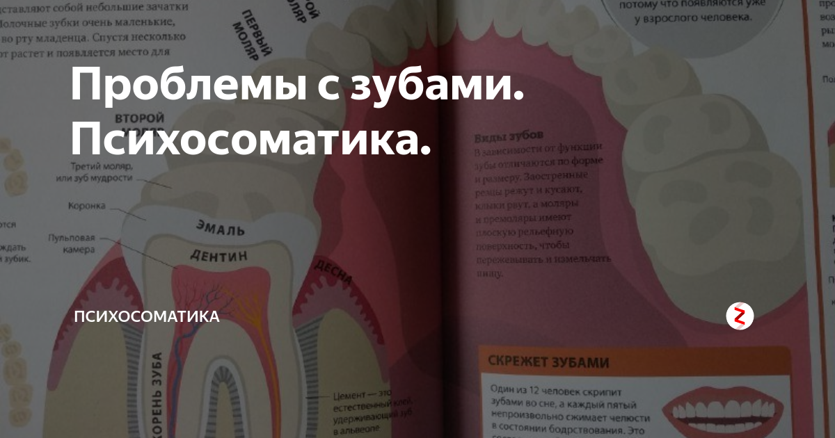 Болят зубы с правой стороны. Зуб мудрости психосоматика. Психосоматика болезней зубы. Психосоматика зубы и десны. Разрушение зубов психосоматика.