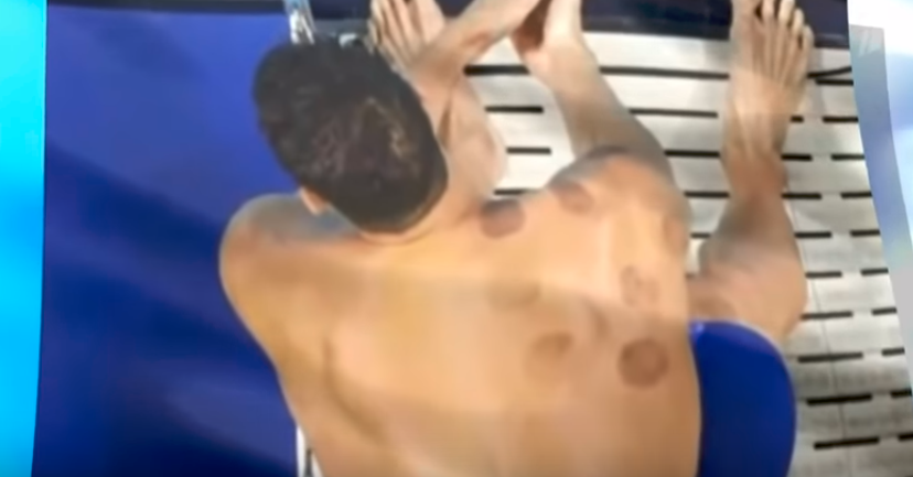 -2