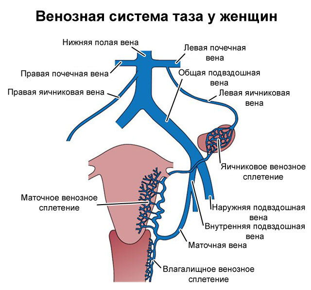 Варикоз промежности и половых губ - консультации и лечение в Инновационном сосудистом центре