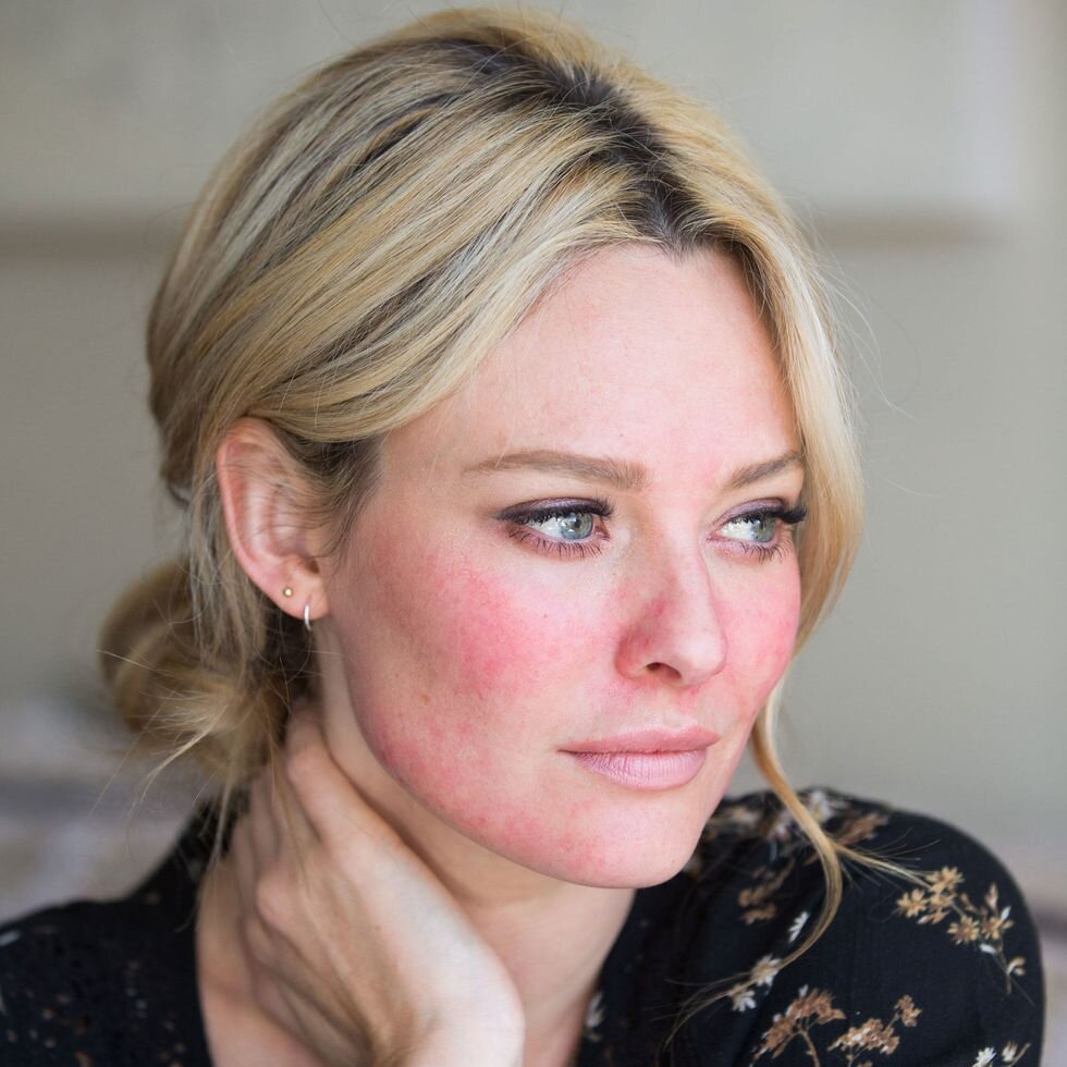 покрасневшее лицо от мороза 