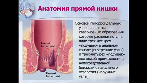 Меновазин при геморрое: состав, применение, побочные действия, отзывы, цены