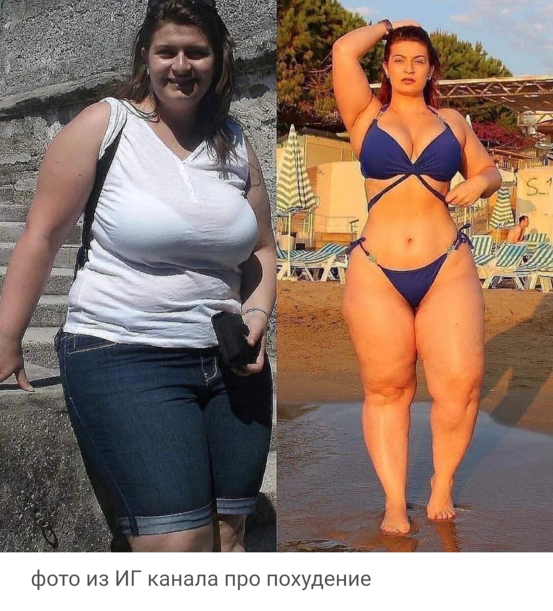 Девушка значительно похудела, прекрасная талия, но ногиииии... 