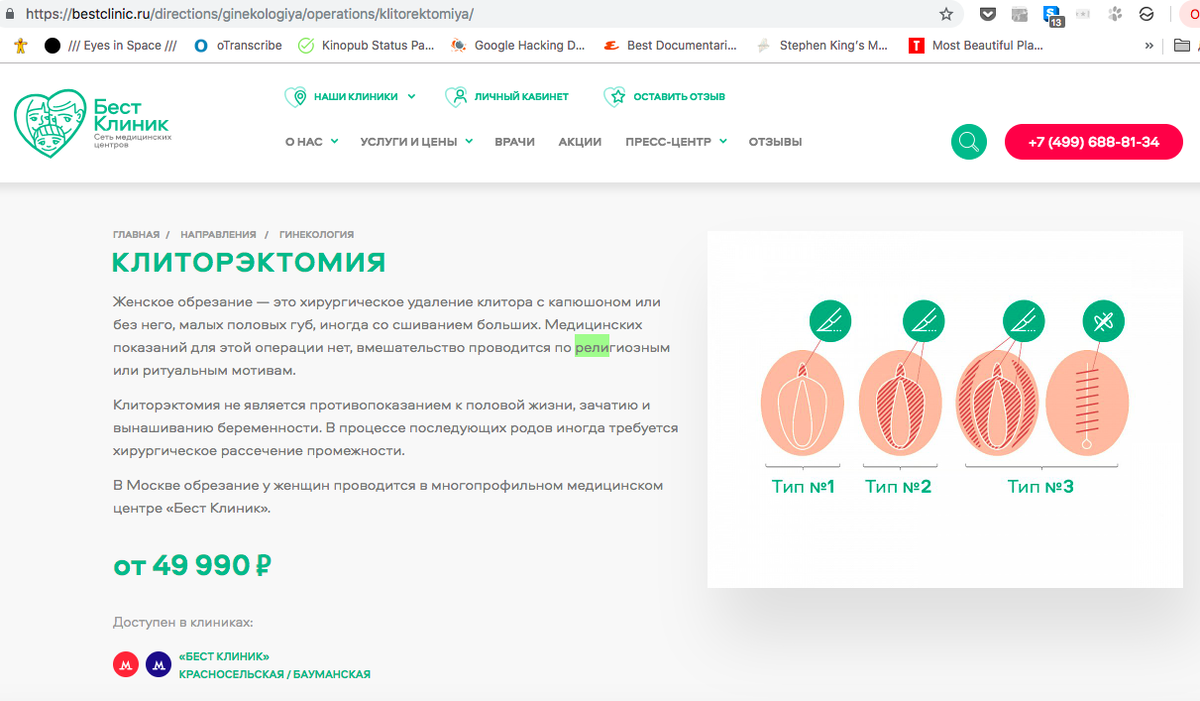 Коррекция половых губ стоимость операции, цены в Москве - Дека Клиника