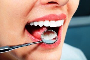 Системы домашнего отбеливания и их преимущества