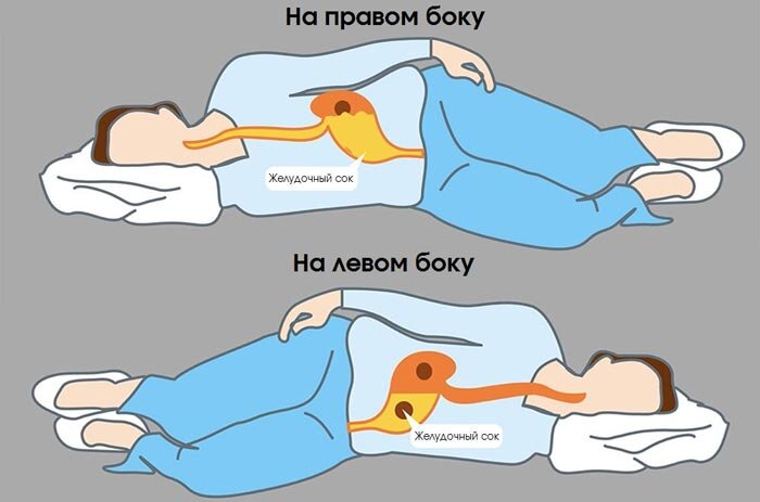 Почему нужно спать на левом боку? | ЗикЗак