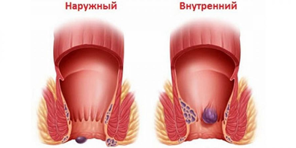 фото: https://proktoinfo.ru