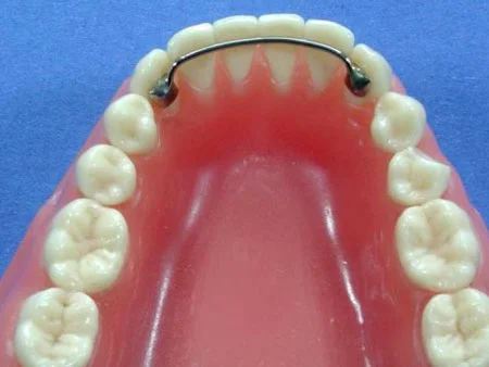 Источник: https://ozubkah.ru