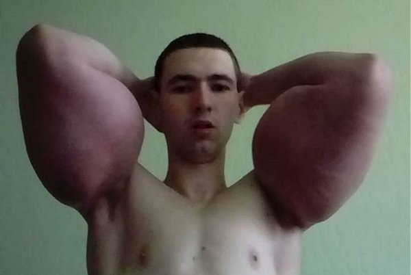 -2-2