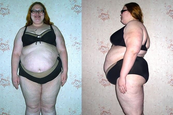 Анна Стафеева до похудения