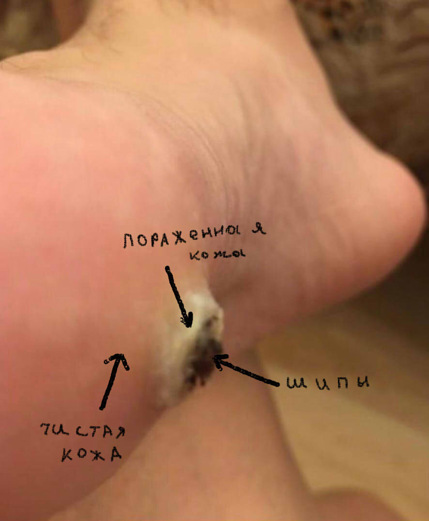 прошло 2 недели и шипов еще больше!