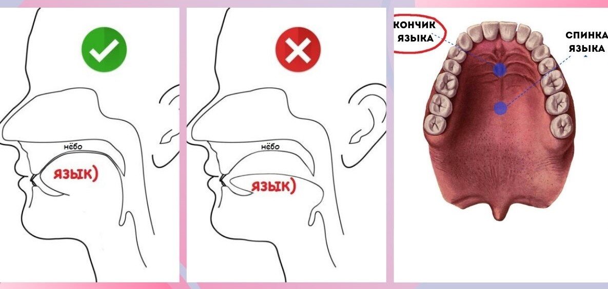 Как должен лежать язык во рту Shtampik.com