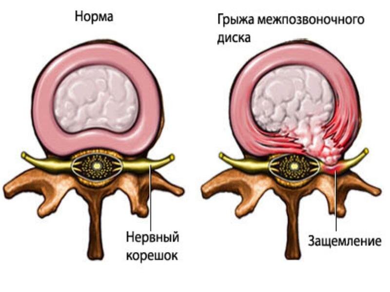 Иллюстрация: puls-center.kz