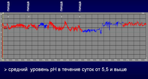 Истоочник: https://protrakt.ru 