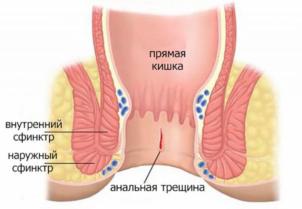 Попа после анального секса (80 фото)