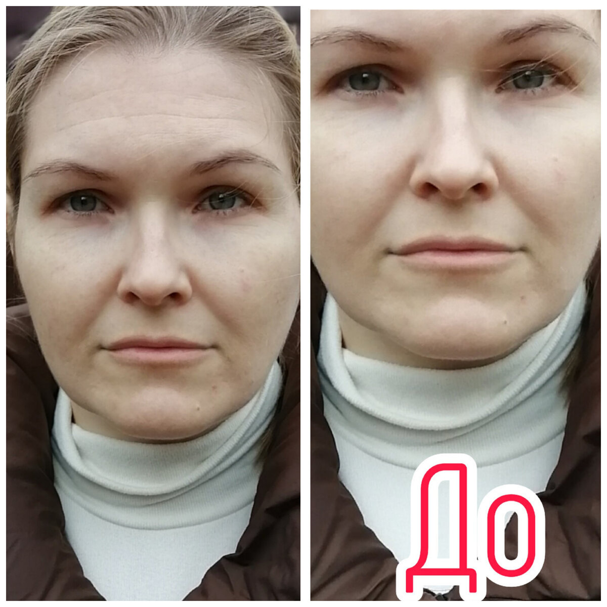 Лицо до и после монако