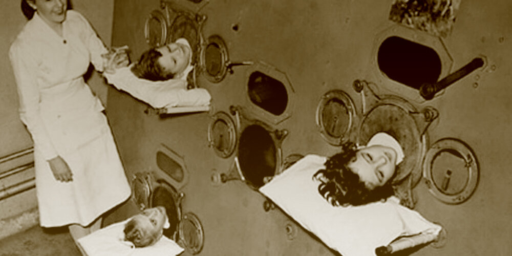 На снимке: Железные легкие (1930-е годы), США.