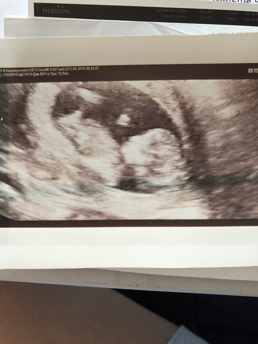 Будет мальчик