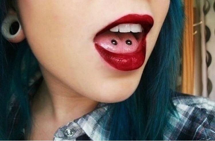 Современное ортодонтическое лечение даёт возможность выбора аппаратуры, чтобы сделать его максимально комфортным с эстетической точки зрения. 