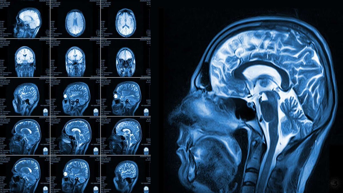 МРТ головного мозга: что показывает, когда требуется диагностика | ЦМРТ:  лечебно-диагностические центры | Дзен