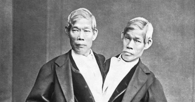 Сиамские близнецы, Чанг и Энг.