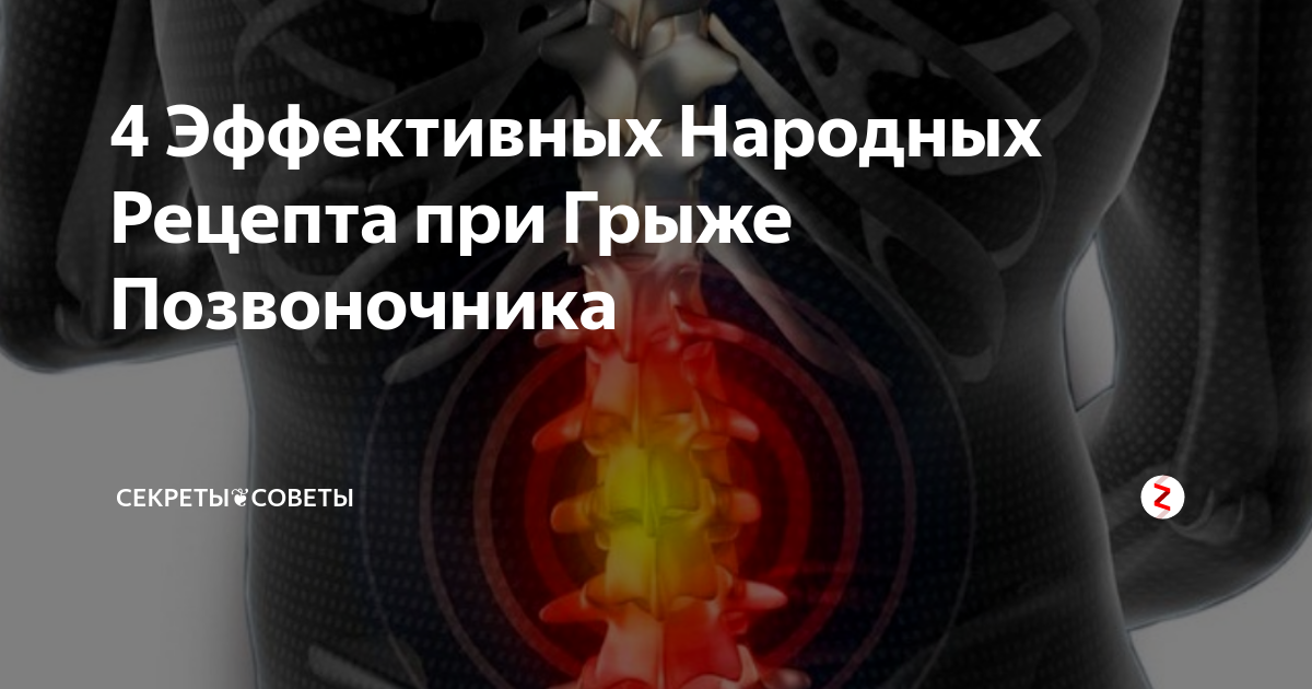 Вода при грыже позвоночника. Народные средства от болей в позвоночнике. Заговор от грыжи на позвоночнике. Боль от грыжи позвоночника. Заговор от грыжи шейного отдела позвоночника.