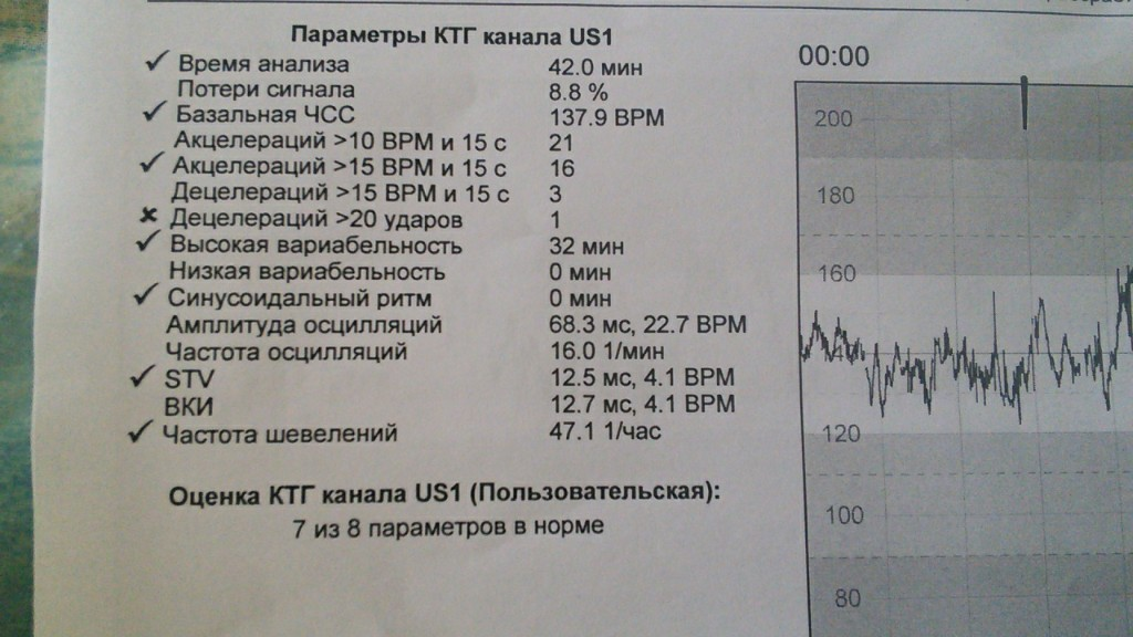 КТГ плода с расшифровкой сделать по доступной цене | ЛДЦ Кутузовский