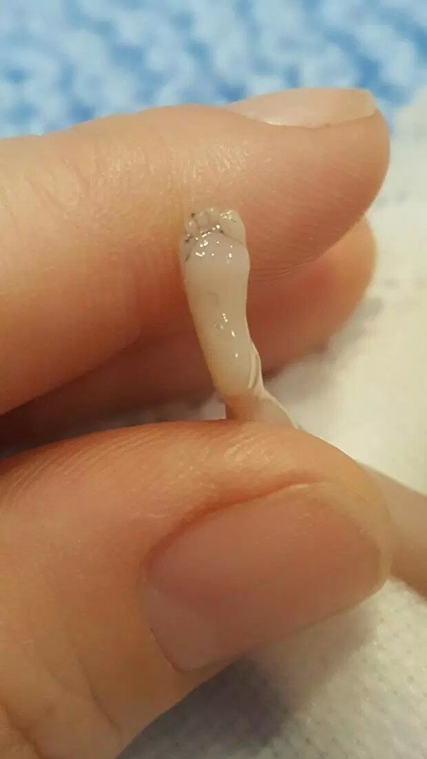 Плод в 14 недель, ножка