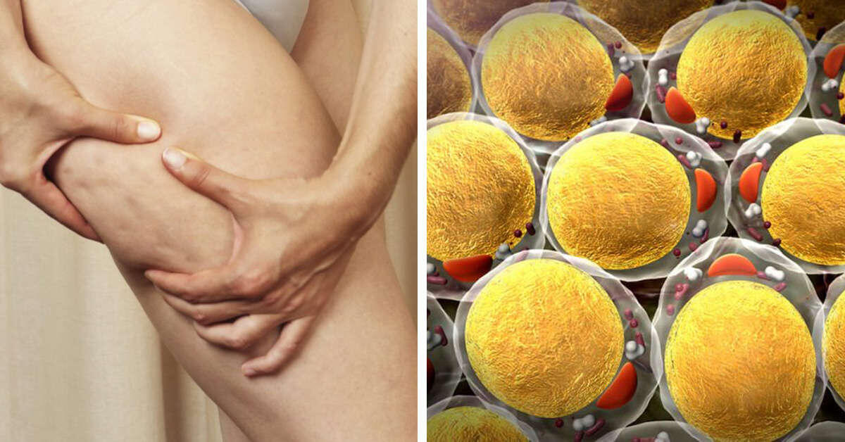 Жировые ткани на ноге