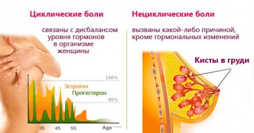 Подскажите!!Грудь беспокоит в середине цикла! - 30 ответов на форуме docs-vet.ru ()