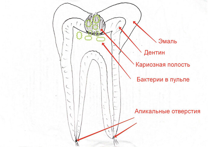 Болит зуб ночью - почему и что делать? | Alma Dent