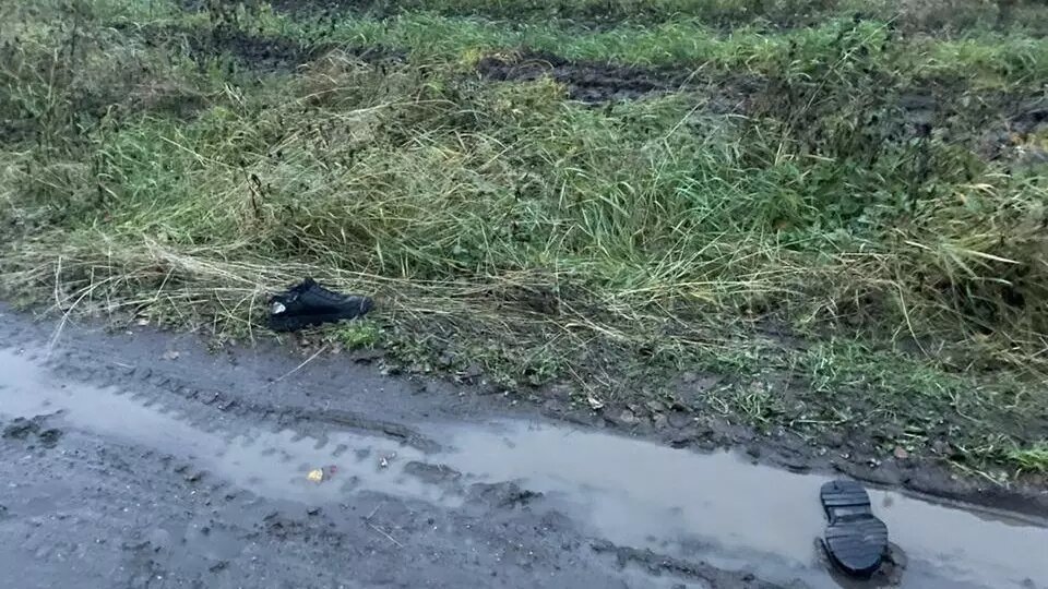     В больнице в Туруханске скончался 15 летний подросток — до этого он загорелся и получил сильные ожоги.