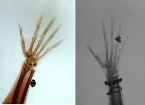 Рентгеновские снимки кистей рук Императора Николая Александровича (слева) и Императрицы Александры Федоровны (справа), выполненные в 1898 году (Из собрания библиотеки Гарвардского университета (США).