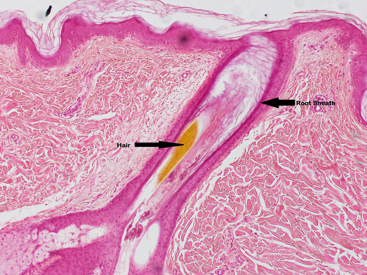 Это окрашенный препарат, очень тонкий срез. В самом центре - зачаток волоса.