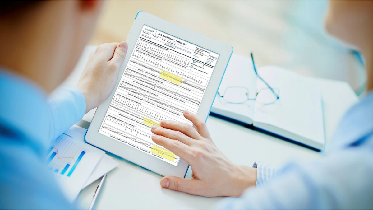 RhythmAnalytics: Обнаружить аритмию с помощью приложения на базе AI 