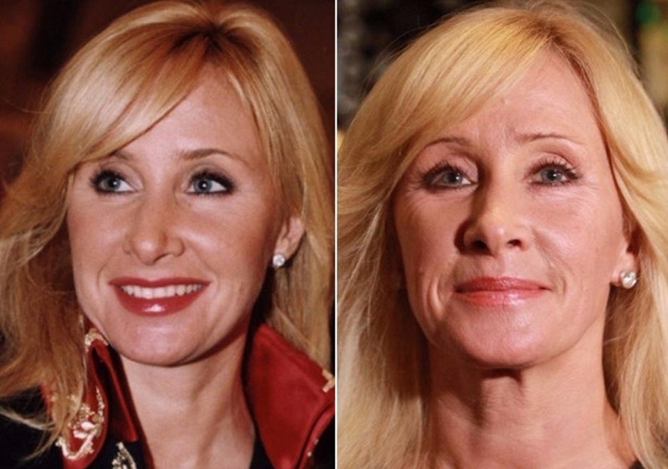 Оксана Пушкина фото до/после