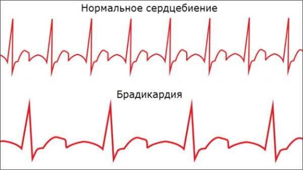 Секс при заболеваниях сердца — можно или нет? Уролог расскажет прямо сейчас