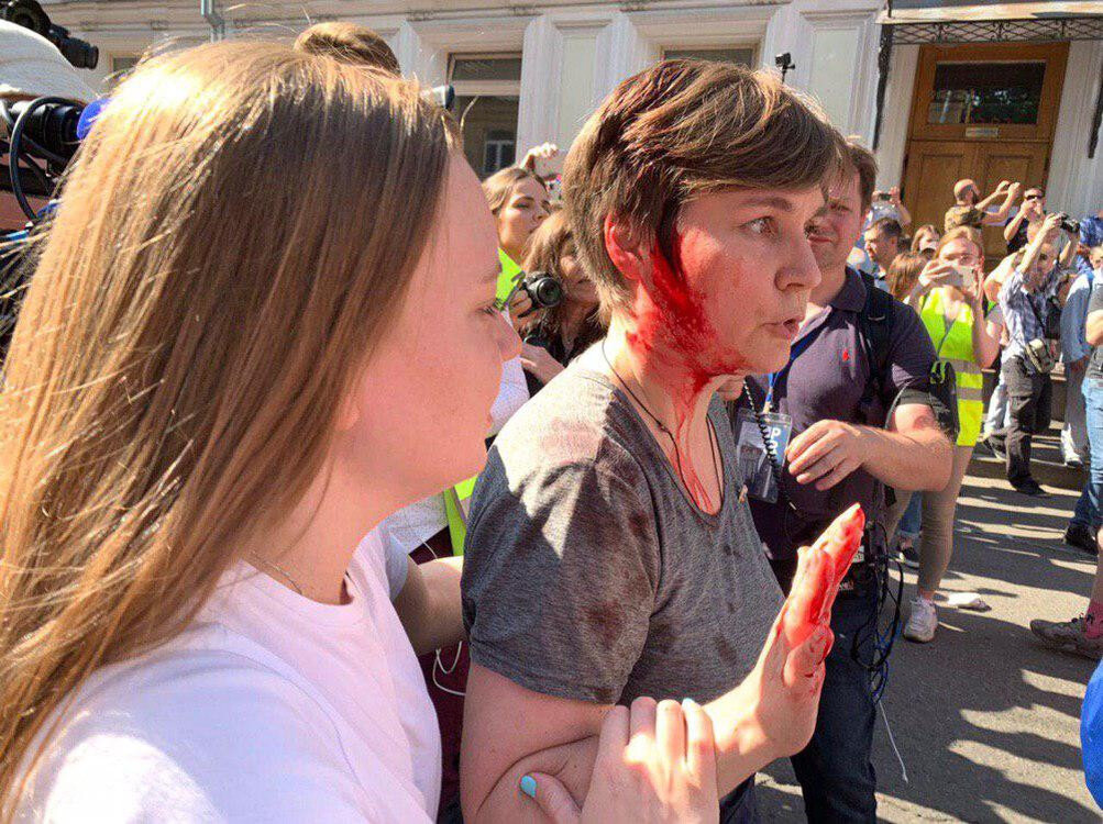 Сотрудники ОМОНа разбили голову депутату Александре Парушиной.