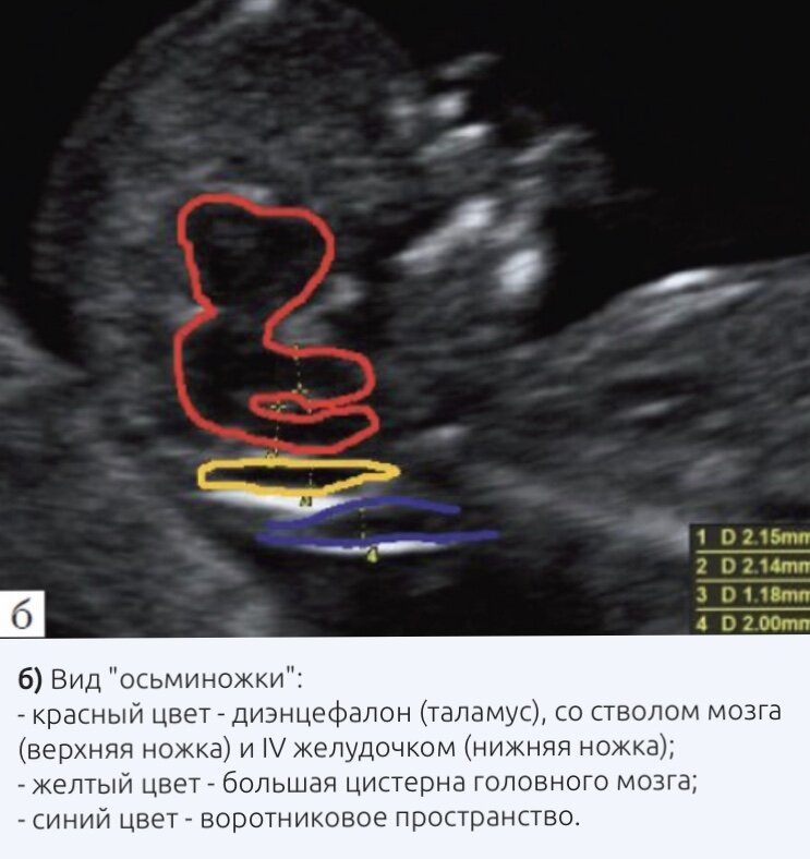 Фото с сайта medison.ru