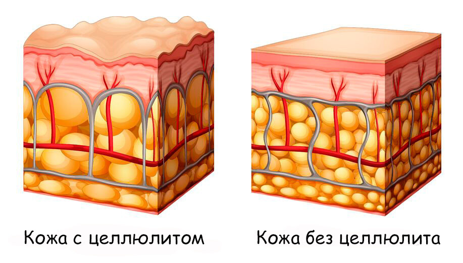 мы видим, как жировые клетки, набирая в себя жиры, разбухают.