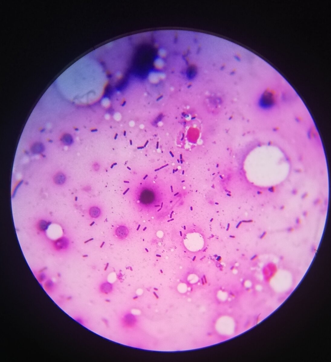 Clostridium perfringens