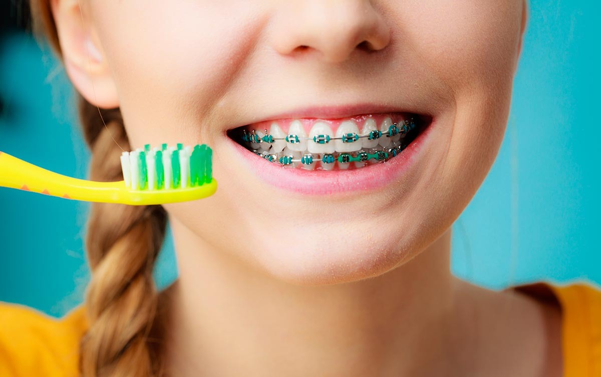 Исправление прикуса у детей в Симферополе