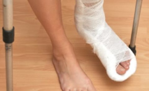  Повреждение стопы.