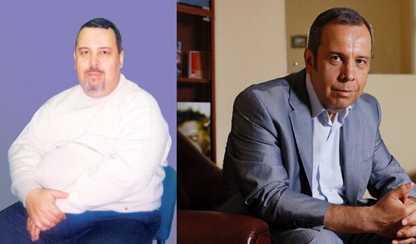 Врач Ковальков: до и после похудения