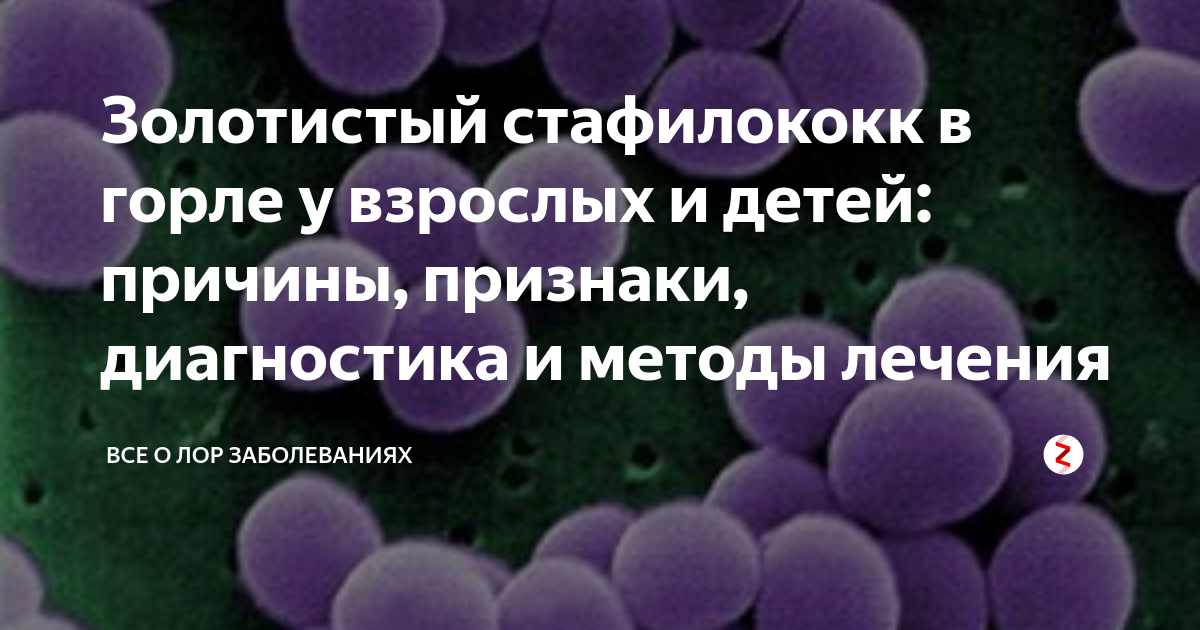 Как правильно лечить стафилококк в горле | Наш дом в Новороссийске | Дзен