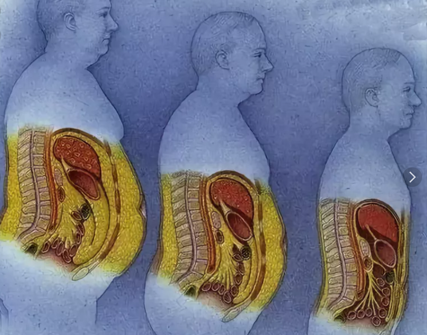 Почему с возрастом растет живот. Висцеральный жир анатомия. Человеческий жир в разрезе.