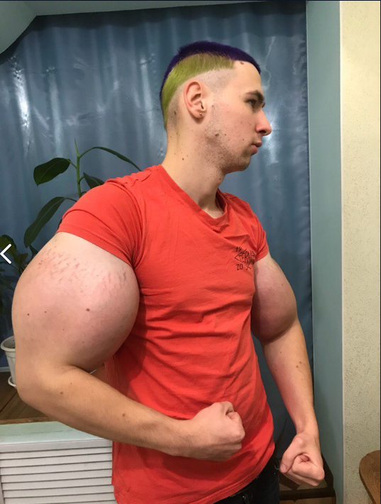 -2