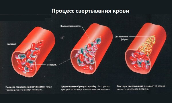 Причины повышения вязкости крови