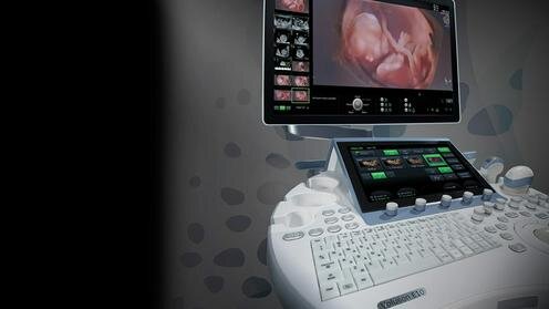  Ультразвуковой аппарат Voluson P6 от компании GE Healthcare. Фото с сайта Gehealthcare.com.sg