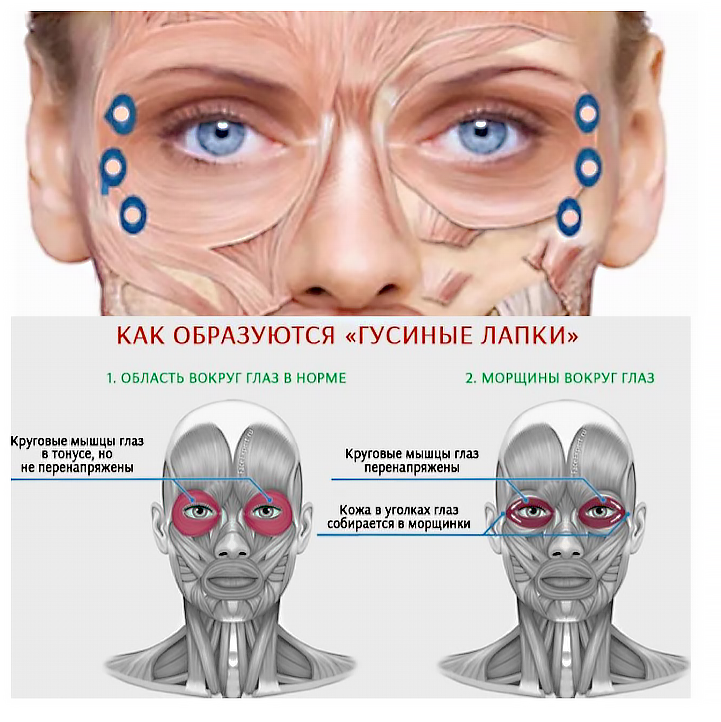 Как укрепить косые мышцы глаза