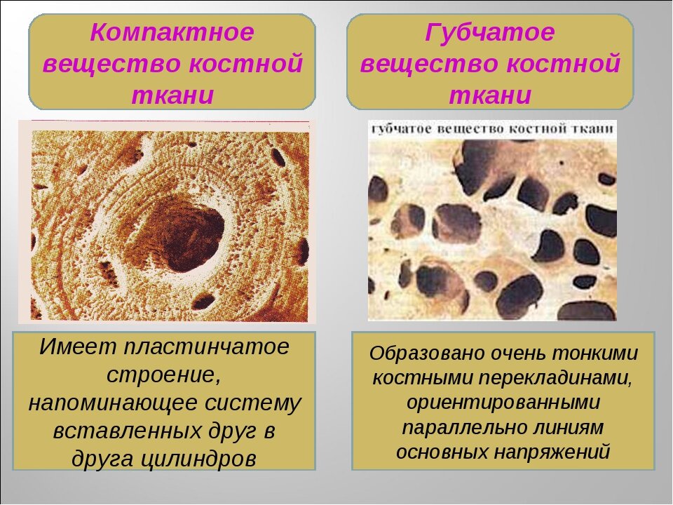 Как выглядит костная ткань